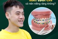 Mặt lưỡi cày có nên niềng răng không? What Are The Risks Of Ignoring Mental Health Issues